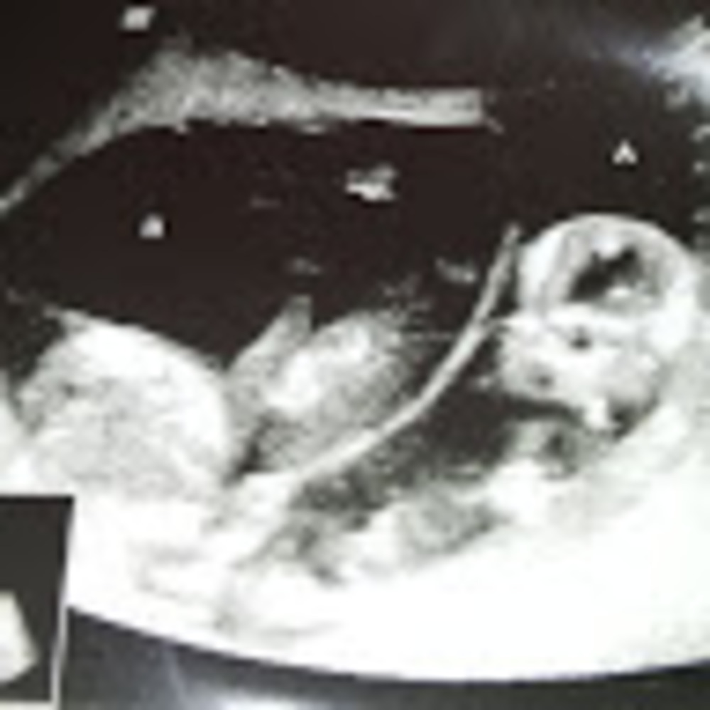 Meet your Posher, 5 boys &